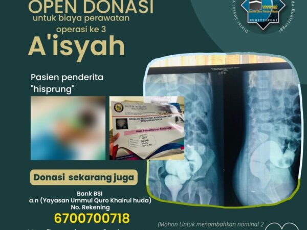 TA'AWUN BIAYA MERAWAT AISYAH PENDERITA HISCPRUNG