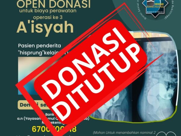 TA’AWUN BIAYA MERAWAT AISYAH PENDERITA HISCPRUNG DITUTUP