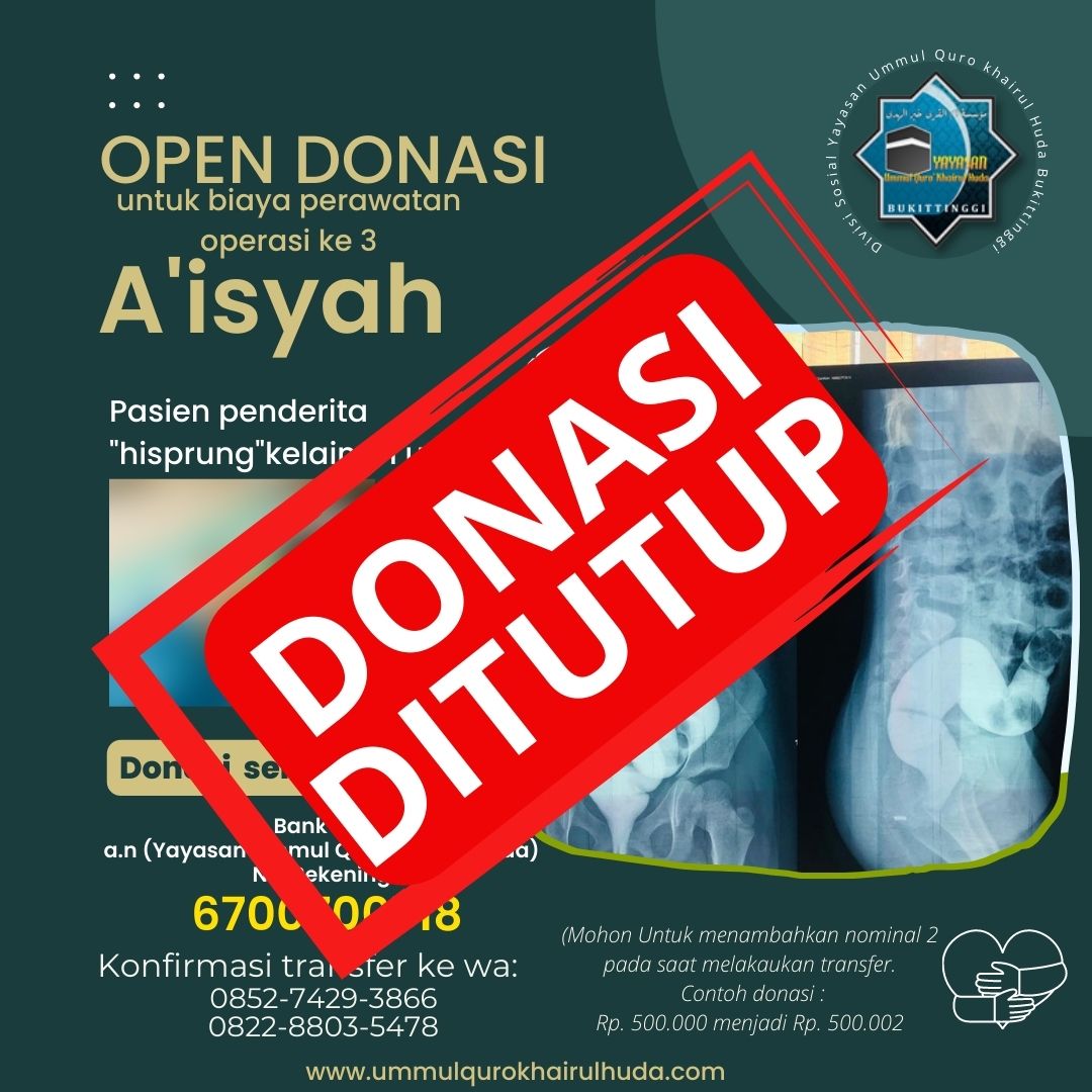 TA’AWUN BIAYA MERAWAT AISYAH PENDERITA HISCPRUNG DITUTUP TA’AWUN BIAYA MERAWAT AISYAH PENDERITA HISCPRUNG DITUTUP